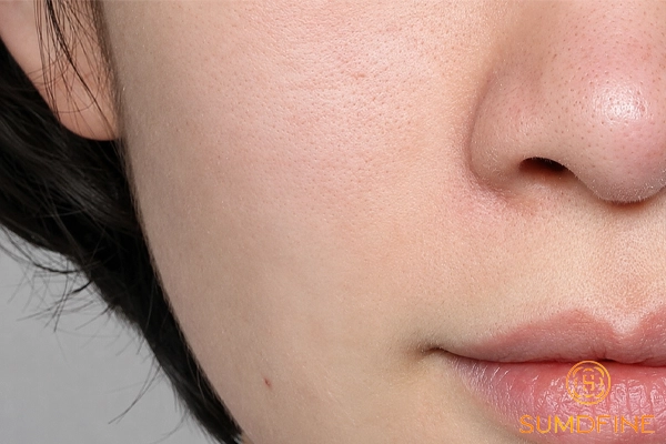 Dùng Retinol da bị khô bong phải xử lý ra sao để nhanh hết? 4 Xử lý da bị khô do retinol bằng cách cấp ẩm