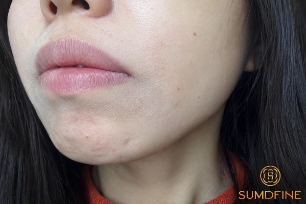 5 cách xử lý da khô căng sau khi rửa mặt để da ẩm mịn trở lại 4 Những nguyên nhân rửa mặt xong bị khô căng da