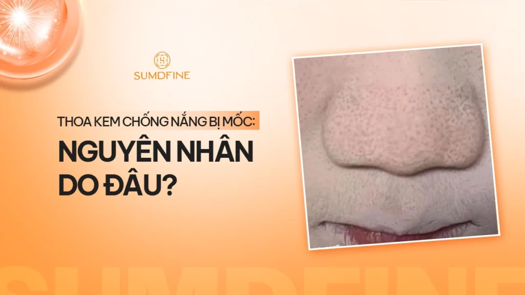 Bôi kem chống nắng bị mốc, lộ vân kem: 7 cách khắc phục 1 Vì sao thoa kem chống nắng bị mốc