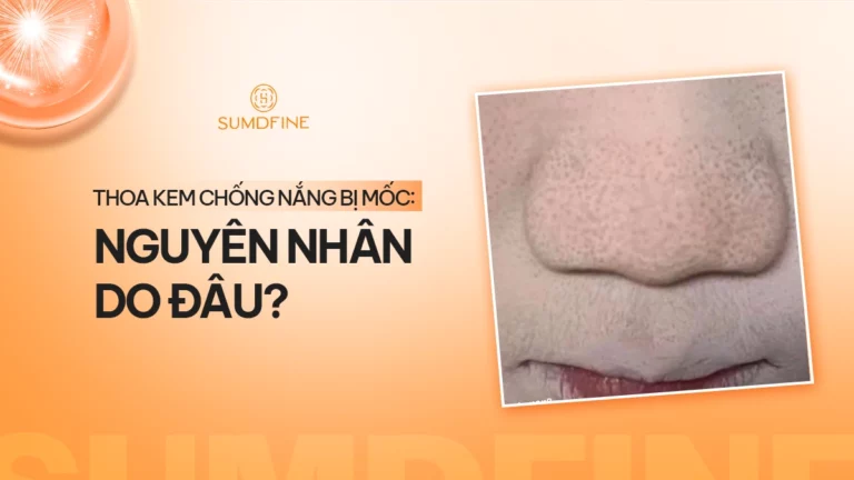 Bôi kem chống nắng bị mốc, lộ vân kem: 7 cách khắc phục