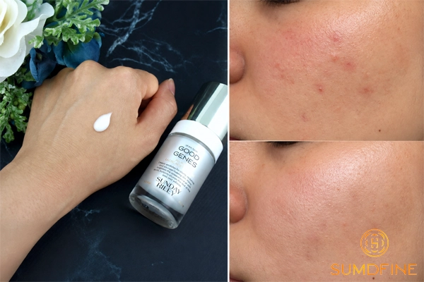 Top 9 serum tái tạo da hiệu quả được người dùng đánh giá cao 6 Sunday Riley Good Genes All-In-One AHA Lactic Acid Treatment
- Serum tái tạo có tốt không?