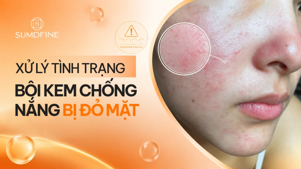 Vì sao bôi kem chống nắng bị đỏ mặt