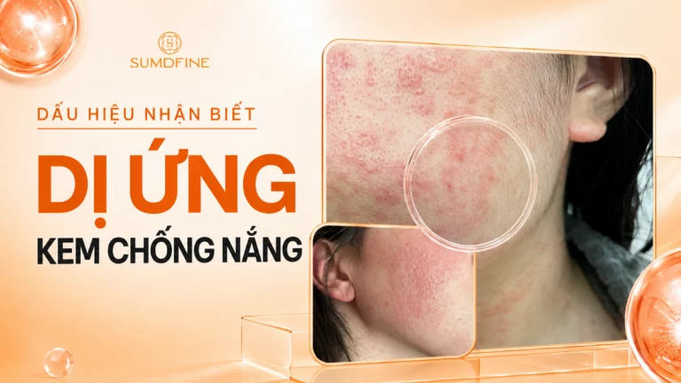 Dị ứng kem chống nắng: dấu hiệu và cách xử lý đúng