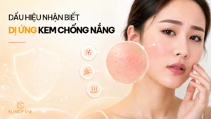 Cách nhận biết dị ứng kem chống nắng