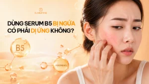 Tại sao dùng serum b5 bị ngứa