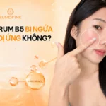 Dùng serum B5 bị ngứa: dấu hiệu dị ứng hay kích ứng?
