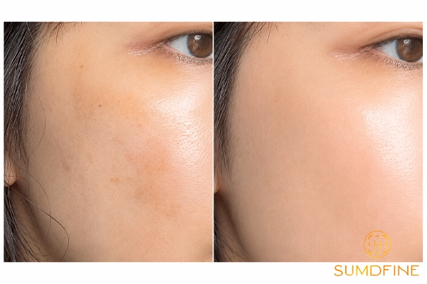 Top 8 kem ức chế sắc tố giúp giảm thâm, đốm nâu và làm đều màu da 5 Transino Whitening Repair Cream EX có trị sắc tố tốt không?