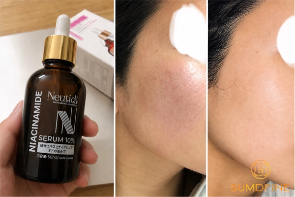 Top 7 Serum Cấp Ẩm Riêng Cho Da Dầu, Không Bí Hay Nhờn Rít 4 Đánh giá Neutidi Niacinamide 10% - serum cấp ẩm, kiềm dầu và làm đều màu da cho da dầu