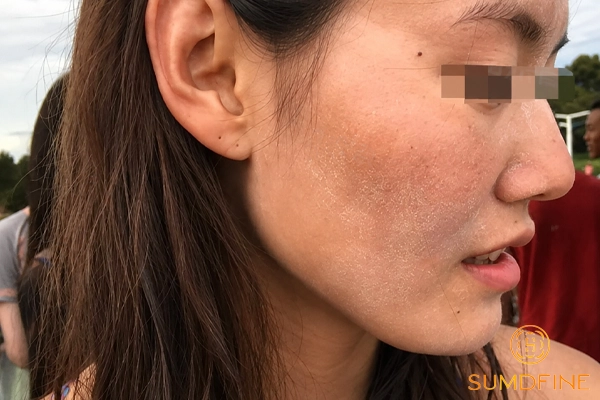 Vì sao đã dùng kem chống nắng nhưng da vẫn bị sạm đen, xỉn màu? 5 Nguyên nhân sạm da có thể không tới từ kem chống nắng