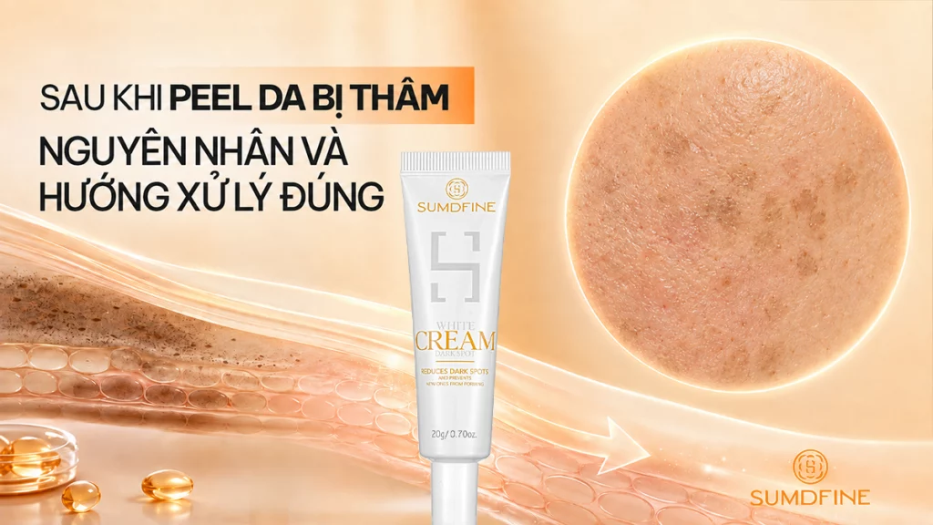 Sau khi peel da bị thâm sạm