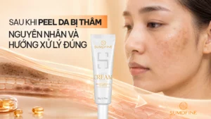 Sau khi peel da bị thâm phải làm sao