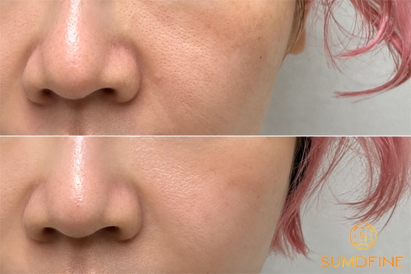 Top 9 serum tái tạo da hiệu quả được người dùng đánh giá cao 3 Chọn serum tái tạo phù hợp với nhu cầu, vấn đề da