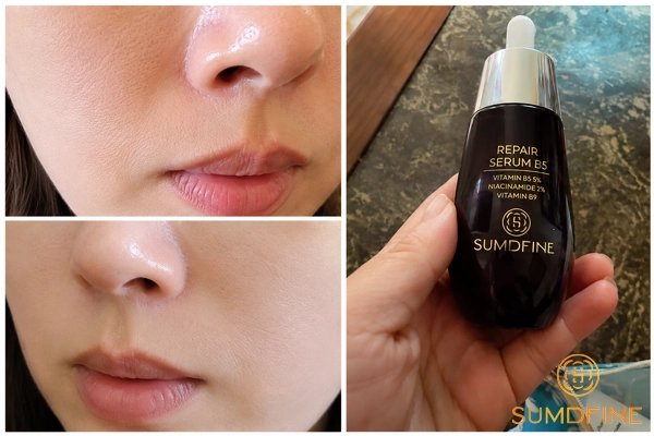 Top 7 Serum Cấp Ẩm Riêng Cho Da Dầu, Không Bí Hay Nhờn Rít 1 Trên tay trải nghiệm serum Sumdfine Repair Serum B5 - cấp ẩm cho da dầu có tốt không