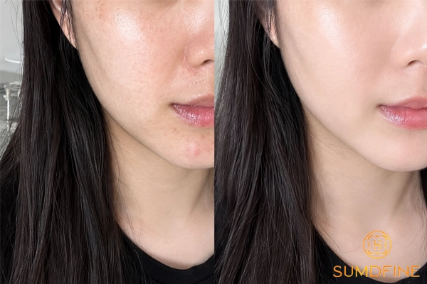 Top 7 Serum Cấp Nước Hiệu Quả, Không Nhờn Dính Hay Nặng Mặt 2 Trải nghiệm khả năng cấp nước của serum Sumdfine Repair B5