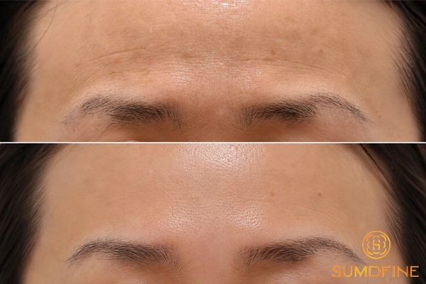 Top 9 serum tái tạo da hiệu quả được người dùng đánh giá cao 2 Serum tái tạo da là gì?