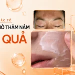 Top 8 kem ức chế sắc tố giúp giảm thâm, đốm nâu và làm đều màu da