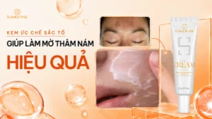 Top các kem ức chế sắc tố melanin hiệu quả, đáng dùng 2026