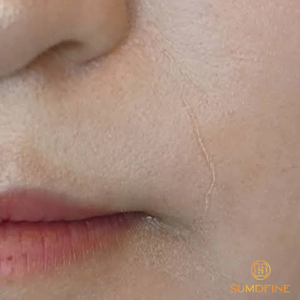 Môi trường nóng ẩm làm trôi kem chống nắng trên da