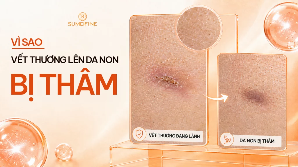 Vết thương lên da non bị đỏ, thâm: Nguyên nhân & Cách xử lý 1 Vết thương lên da non bị thâm
