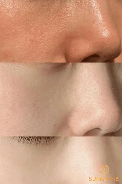 Lý do da mặt đen hơn da cơ thể & Cách xử lý hiệu quả 10 Sau bao lâu thì da mặt trắng đều với da cơ thể?