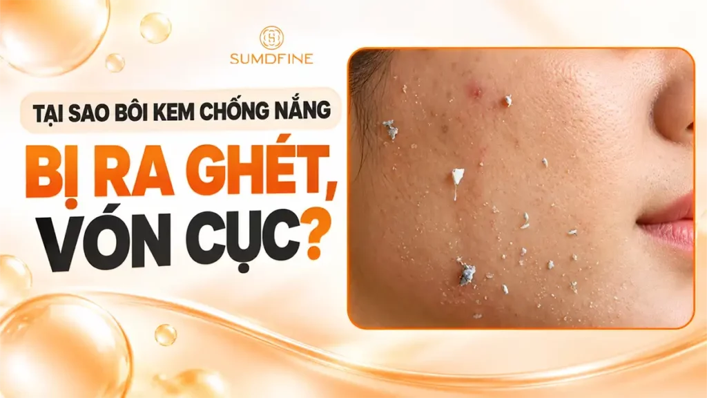 Bôi kem chống nắng bị vón cục, ra ghét