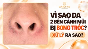 Da 2 bên cánh mũi bong tróc