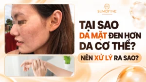 Tại sao da mặt lại đen hơn da tay, da cơ thể?