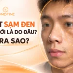 5 cách cải thiện da mặt sạm đen ở nam giới hiệu quả