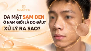 Tình trạng da mặt bị sạm đen ở nam giới