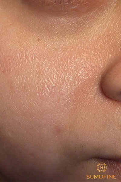 Dấu hiệu da thiếu ẩm: 7 biểu hiện và cách tự kiểm tra ở nhà 5 Cách tự kiểm tra xem da có thiếu ẩm hay không?