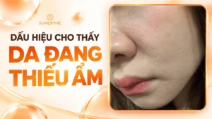 Dấu hiệu da bị thiếu ẩm