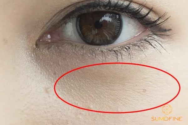 Dấu hiệu da thiếu ẩm: 7 biểu hiện và cách tự kiểm tra ở nhà 3 nếp nhăn li ti cũng là dấu hiệu da thiếu ẩm