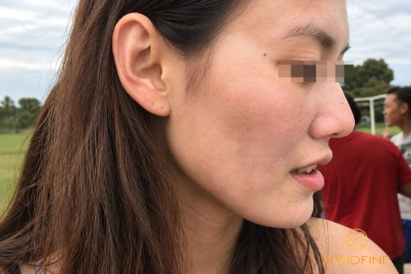 Nhận biết, phân biệt tia UVA và UVB: Loại tia nào nguy hiểm hơn? 4 Tác động của tia UVA lên da