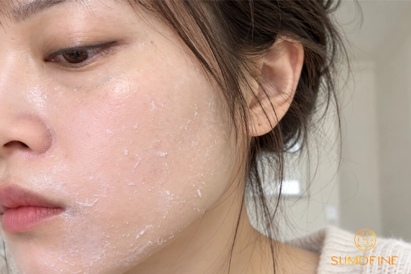 Xử lý khi bôi kem chống nắng bị ra ghét