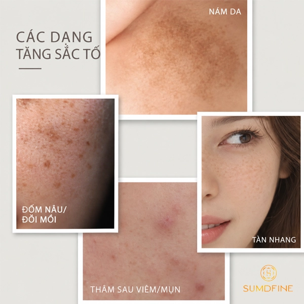 Nhận biết các dạng tăng sắc tố