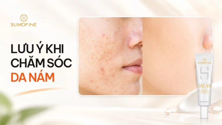 Chăm sóc da nám: Quy trình sáng tối & lỗi khiến nám đậm hơn