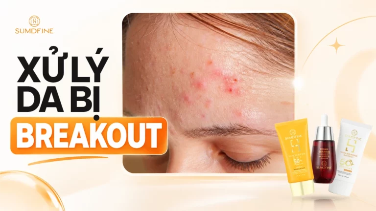 Da bị break out: Dấu hiệu & cách xử lý đúng giúp giảm mụn hiệu quả