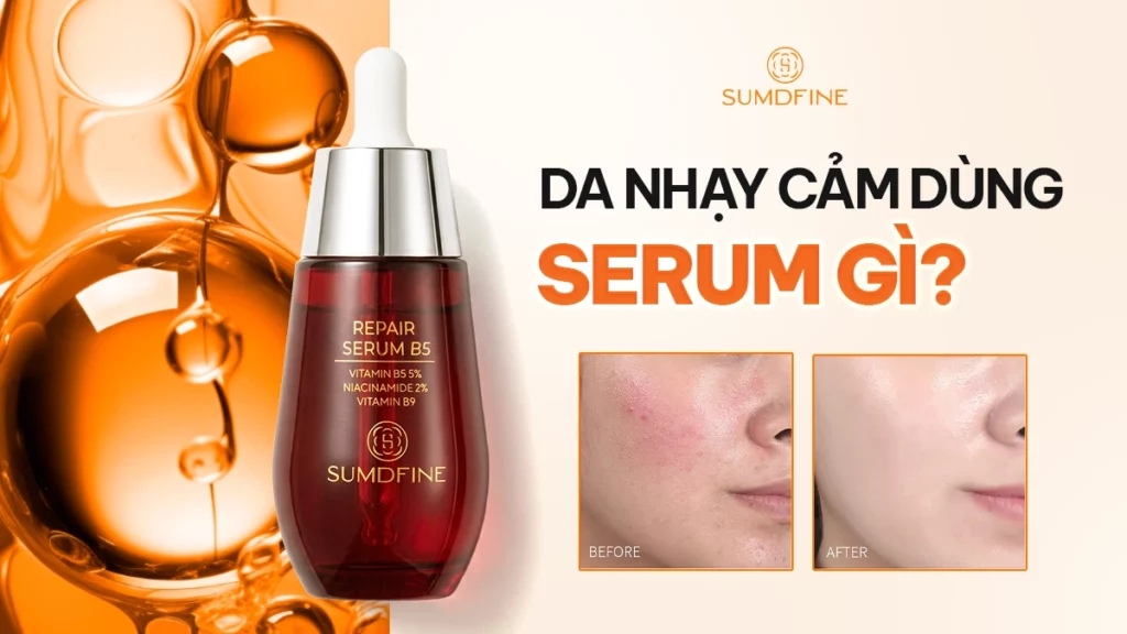 Serum cho da nhạy cảm