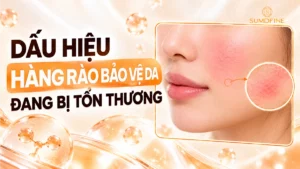 Dấu hiệu hàng rào bảo vệ da bị tổn thương