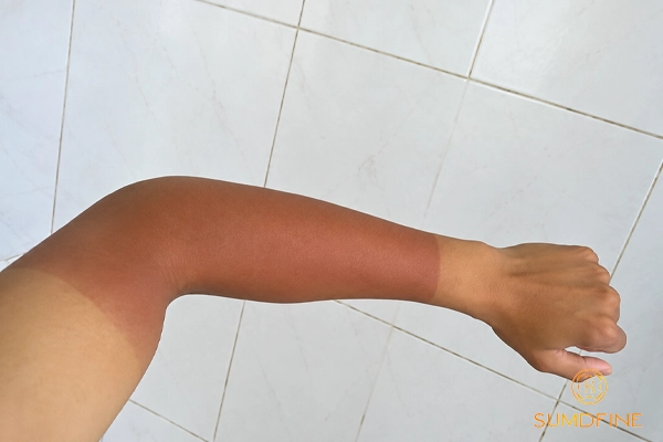 Mấy giờ hết tia UV? Giờ nào ra nắng ít lo bị sạm da? 3 Tia uv yếu vẫn có thể tích tụ gây sạm da về lâu dài