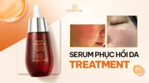 Top serum phục hồi da treatment